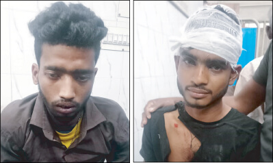 হবিগঞ্জে ডাকাতের হামলায় দুই যুবক আহত