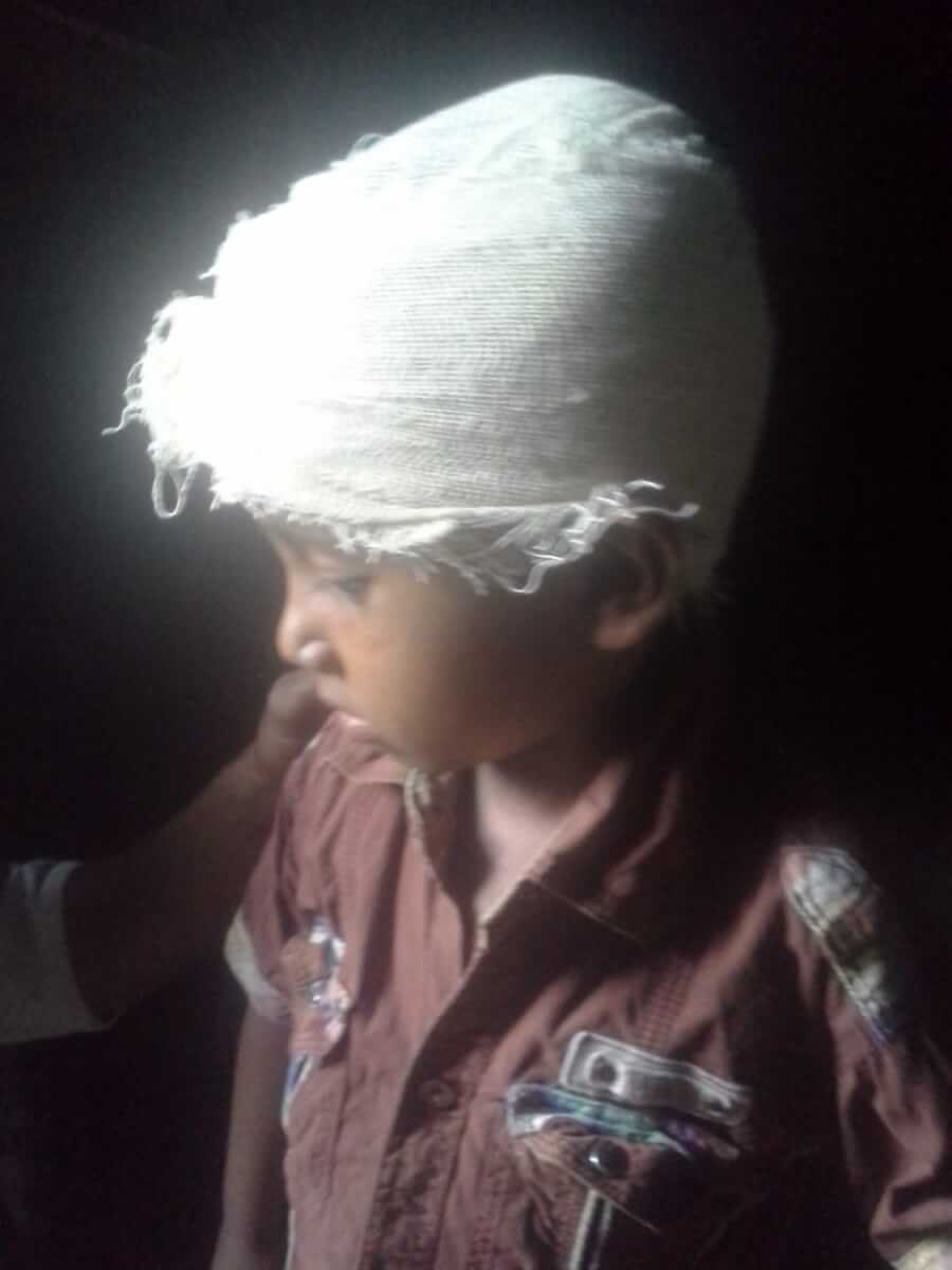 ইজিবাইক দূর্ঘটনায় পাঁচ বছরের শিশু গুরুতর আহত