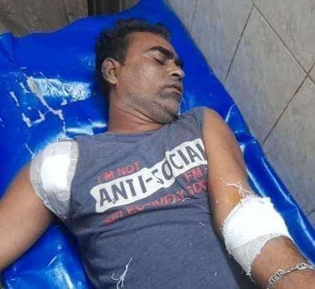 নবীগঞ্জে সাংবাদিক সজীবের উপর সন্ত্রাসী হামলা! রক্তাক্ত অবস্থায় হাসপাতালে ভর্তি