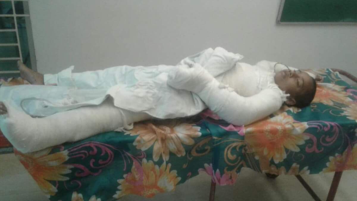 জীবন-মৃত্যুর সন্ধিক্ষণে ঢাকা’র বার্ণ ইউনিটে নিহত ঝুমার আরেক সন্তান পূজা- জামালগঞ্জে বিদ্যুৎস্পৃষ্টে নিহত মা-ছেলে ঝুমা রানীর পরিবারে চলছে শোকের মাতম