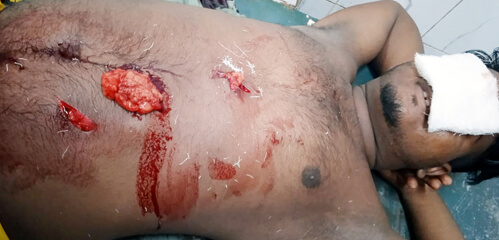 হবিগঞ্জে হোটেল বয়কে ছুরিকাঘাত নারীভূরি বের হয়ে গেছে জুনায়েদের