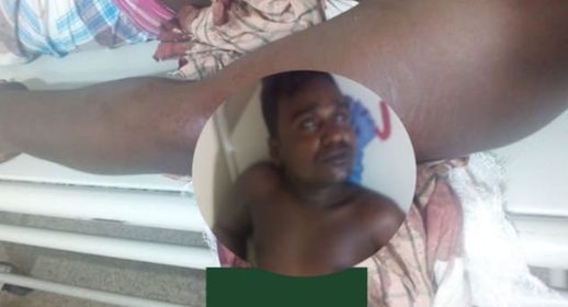 শার্শায় মাদক কেনাবেচায় বাঁধা দেওয়ায় যুবককে কুপিয়ে জখম।