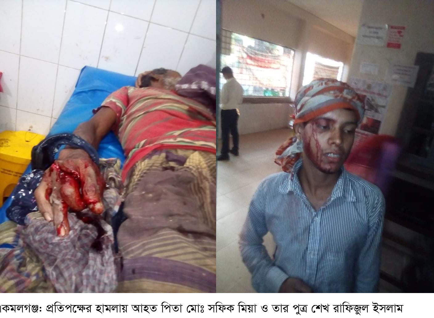 কমলগঞ্জে প্রতিপক্ষের হামলায় পিতা পুত্র আহত