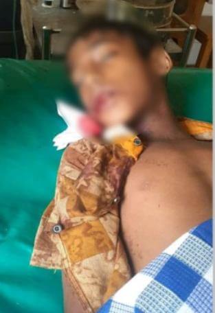 বড়লেখায় সড়ক দূর্ঘটনায় স্কুল ছাত্রের মৃত্যু