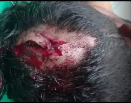 বানিয়াচংয়ে পাওনা টাকা চাওয়ায় যুবককে পিটিয়ে রক্তাক্ত