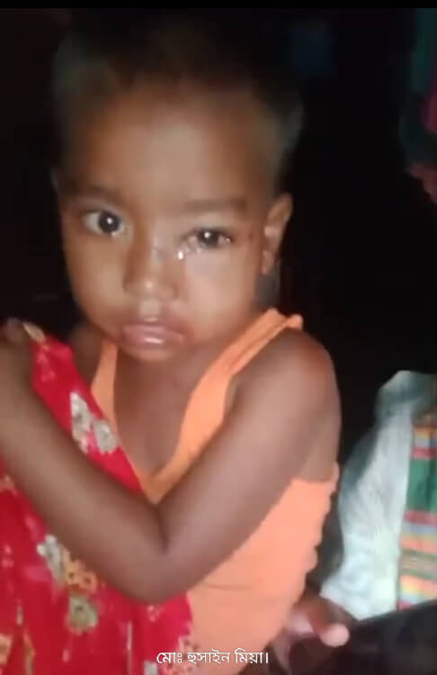 শাল্লায় কুকুরের তাণ্ডব:শিশু ও পরীক্ষার্থীসহ আহত ৯, এলাকায় আতঙ্ক