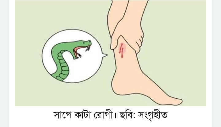 ছোবল দেওয়া সাপটি মেরে সঙ্গে নিয়ে হাসপাতালে হাজির হন